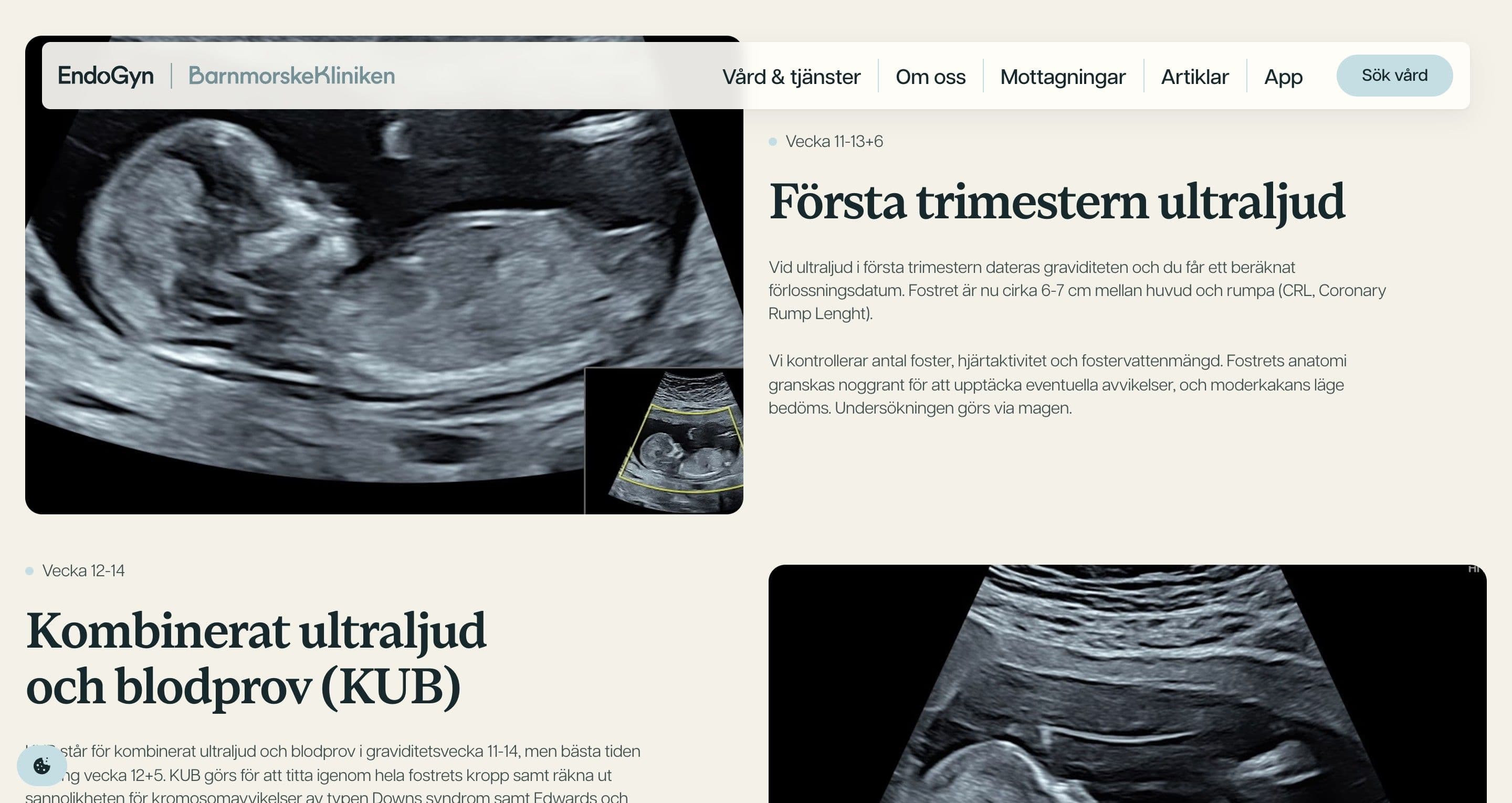 The first-trimester section on barnmorskekliniken.se, ultrasound scans beside week-by-week descriptions of each examination